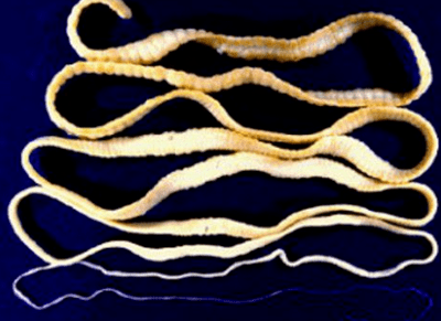 Tseepni