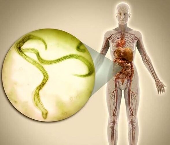 Parasites in the human body