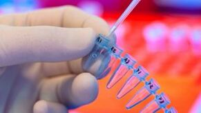 How to be tested for parasites
