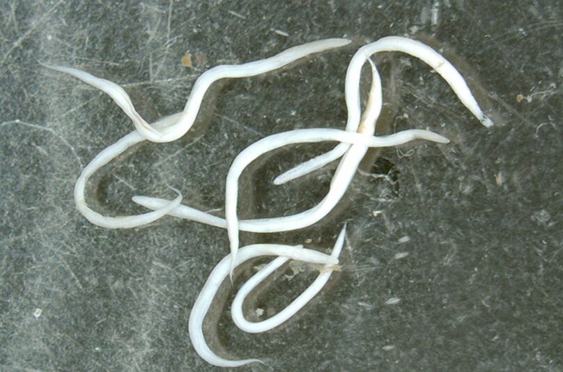 parasitic worm of the human body