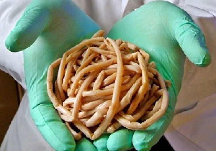 Parasitic worms of the human body