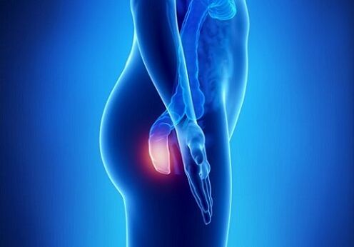 itching in the rectum as an indication for the search for parasites